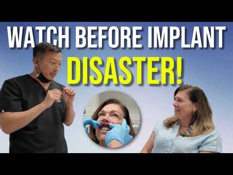 Need a Front Tooth Implant? Watch This Real Implant Consultation w/ A Periodontist Before You Commit