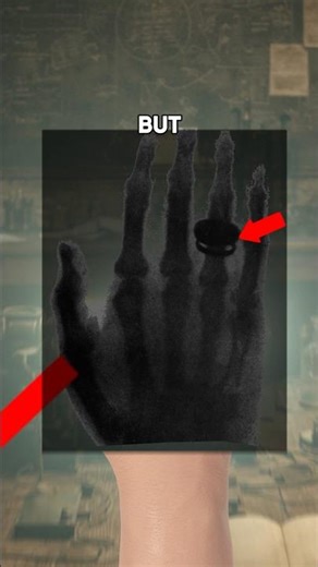 The Invention of X-Ray !!👁️⚡#shorts #facts