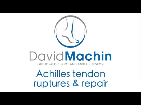 Achilles tendon (Tendo Achilles, or TA) rupture