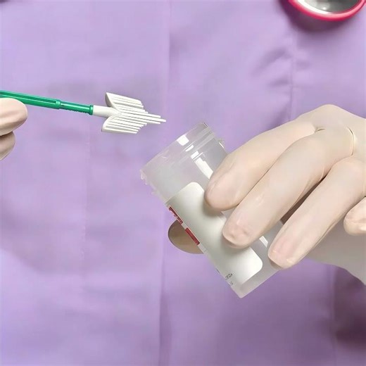 Cervical Cancer Screening What Everyone Should Know