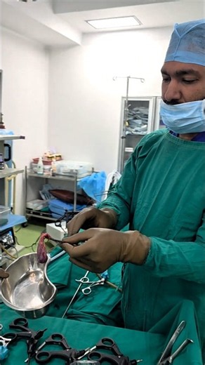Laparoscopic cholecystectomy- How Gallbladder is removed out from a tiny hole?