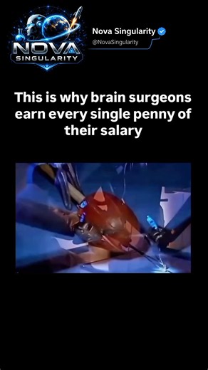 #neurosurgeon #surgery #doctorlife #mindblowing #shorts #youtubeshorts #trending #technology#share #
