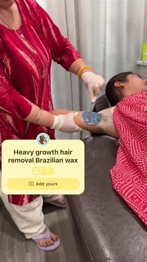 Heavy growth hair removal Brazilian wax used underarm #shortfeed #hairremoval #thicker #hairgrowth