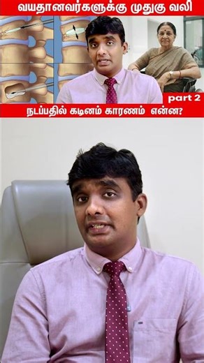 Osteoporosis முதுகுஎலும்பு fracture, என்ன சிகிச்சை? | Dr Vijayaraghavan