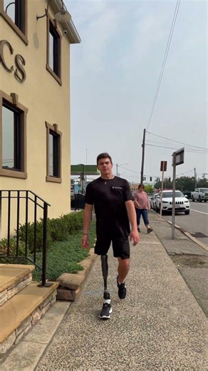 Smooth Walking with a Hemipelvectomy Prosthesis | Kristofer