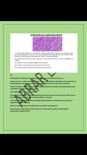 Special pathology Endocrine OSPE Part 2 | Rapid Revision 🔥💉/LUMHS /IMC.