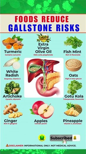Top 10 Foods That Help Reduce the Risk of Gallstone Complications