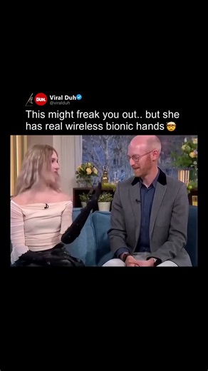These bionic hands are showing just how far prosthetic technology has come 🔥✨
