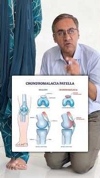 Knee Pain | Chondromalacia patella| Knee pain relief Exercises