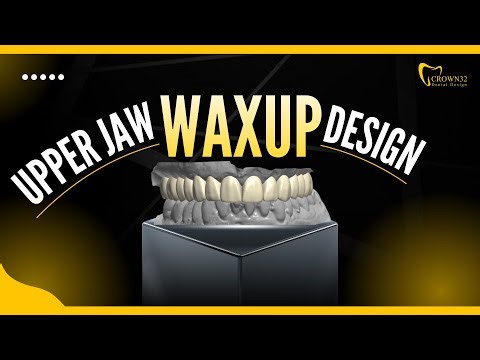 STOP Making These Mistakes in Your Upper Jaw Wax-Up Design