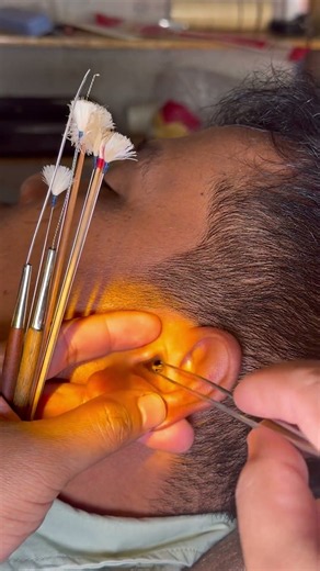 Earwax cleaning removal #asmr #cleaning #wax #message