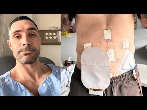 Reece had his colon removed. Here's what happened 😬