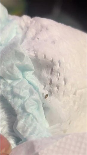What Is This Tiny Brown Speck on a Baby Diaper? 🤔👀 #BabyCare #DiaperCheck #ParentingTips #Shorts