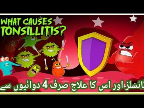 What Causes Tonsillitis? | Tonsils Symptoms & Treatments | Bacterial Infections | Dr Ali Muhammad