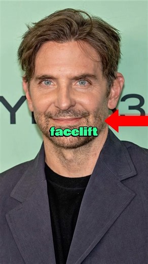 Did Bradley Cooper Get Plastic Surgery?