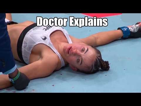 Why Maycee Barber Wasn't Moving After Scary Knockout by Alexa Grasso - Doctor Explains