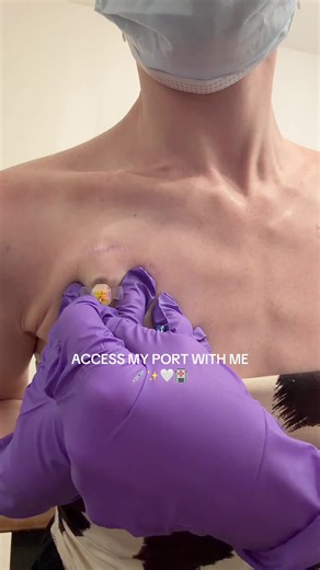 access my port with me💉✨🤍🏥 #port #portacath #asmr #chronicillness #chronicillnessawareness