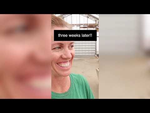 Satisfying Pimple Popping & Cyst Extractions - 128