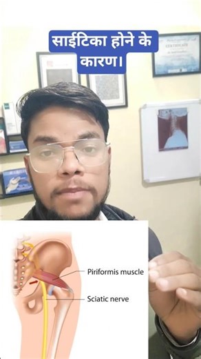 Sciatica ke 3 Common Causes | Pain Ki Asli Wajah #sciatica #nervepain #sciaticapainrelief #fyp
