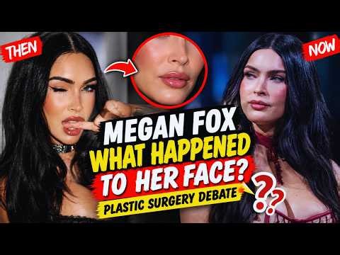 Megan Fox Now | What Happened to Her Face? New Look Sparks Plastic Surgery Debat
