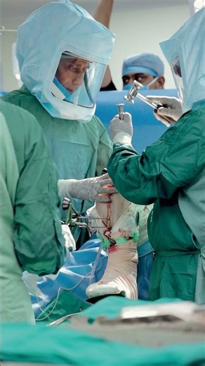 See How Robotic Knee Surgery Brings Precision to the Operating Room Dr Saurabh Goyal #drsaurabhgoyal
