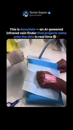 AI Vein Finder Projects Veins on Skin in Real Time 🤯🩺