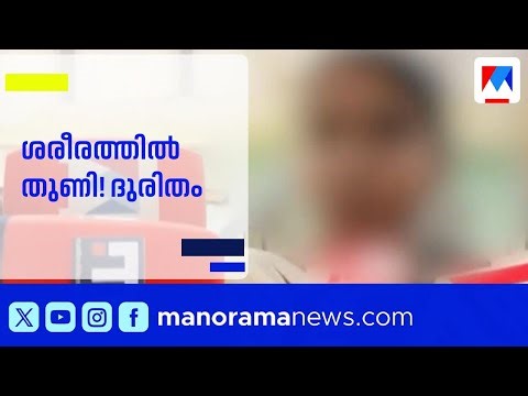 പ്രസവിച്ച യുവതിയുടെ ശരീരത്തിൽ നിന്നും തുണിക്കെട്ട് പുറത്തുവന്നു; പ്രതിഷേധം | Wayanad Medical College