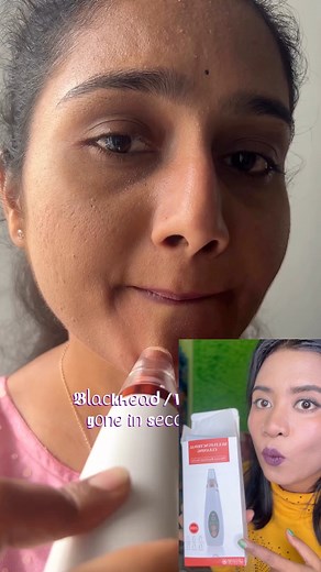 Blackhead remove tool #sathisbeautyworld #beautyhack #blackheadremover #blackheadvacuumtool | Sathi's Beauty World