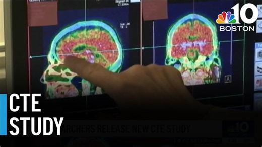 What is CTE? Video explains what to know
