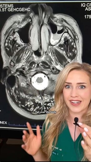 You won’t believe what’s in his brain!