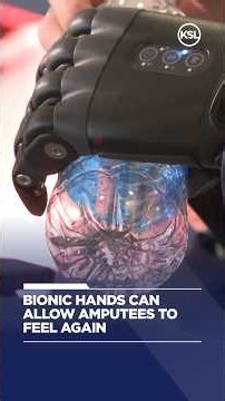 Bionic hands can allow amputees to feel again