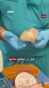 هدى قطان تحذر من مخاطر عدم متابعة الطبيب بعد تمزق حشوات صدرها