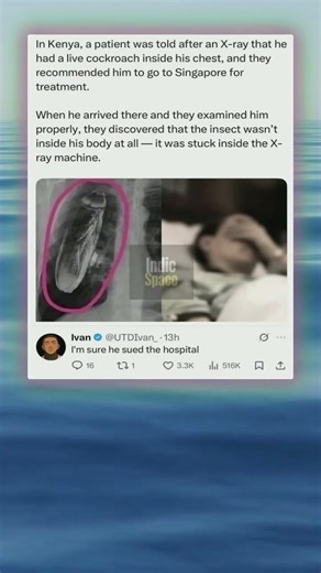 Something was stuck inside the x ray machine and it went viral 😳 #viral