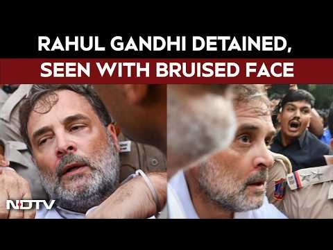 Rahul Gandhi Injured | Rahul Gandhi Detained From Protest Site, Seen With Bruised Face