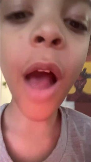 Blue Toad Explodes #mario