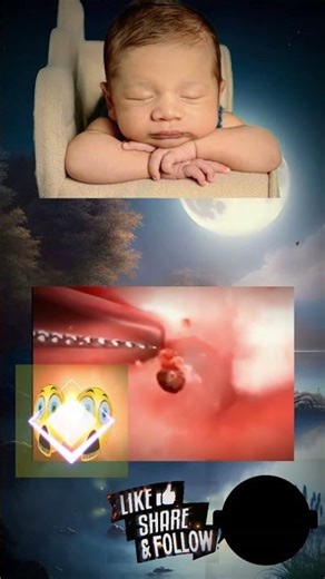 "Satisfying Blackhead Removal – Deep Pimple Popping Close-Up!"