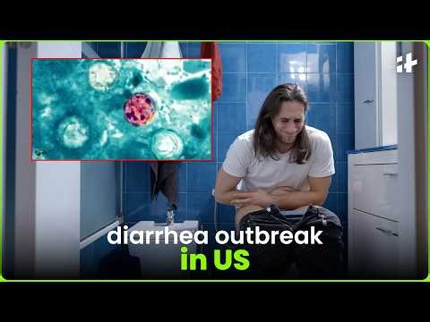 What’s causing the explosive diarrhea outbreak in the US?