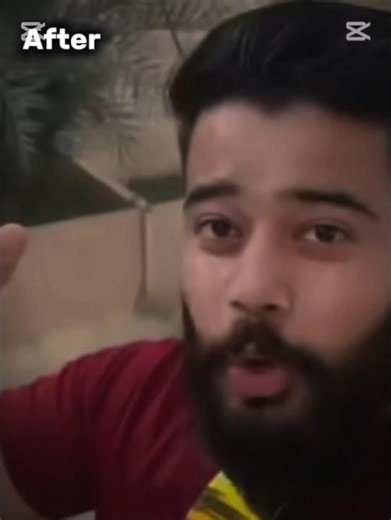 Syed Fahad Before And After 🤯