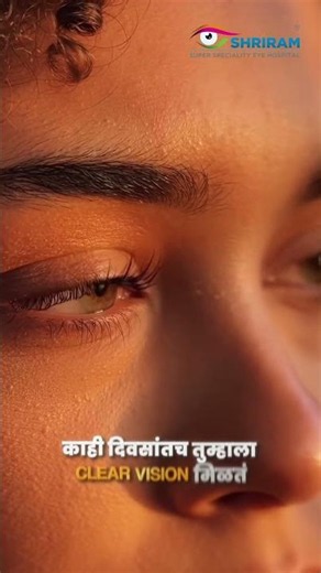 Is Cataract Surgery Safe? | Modern Stitchless Cataract Surgery Explained | Shriram Eye Hospital