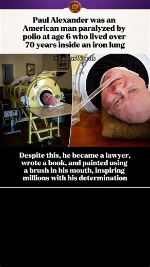 ​The Man Who Lived 70 Years Inside an Iron Lung! 🤯 #shorts #america #usa #sad #motivation #inspire