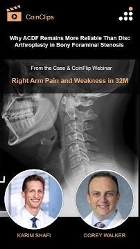 Why ACDF Remains More Reliable Than Disc Arthroplasty in Bony Foraminal Stenosis