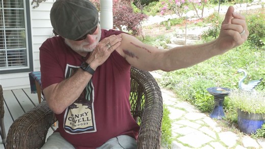 Bear euthanized after attack