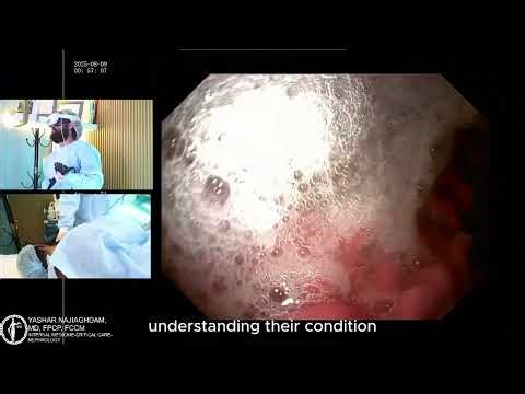 The Future of Endoscopy: AI & Virtual Reality Explained