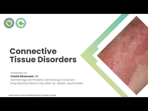 Lecture 19| Connective Tissue Disorders | Dr. Khalid Alhawsawi