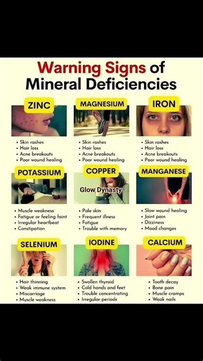 ⚠️ Warning Signs of Mineral Deficiencies | Your Body Is Asking for Help😲 #shorts