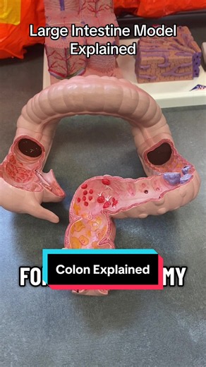 Large Intestine Model explained! #anatomy #colon #coloncancer #stem #medicine