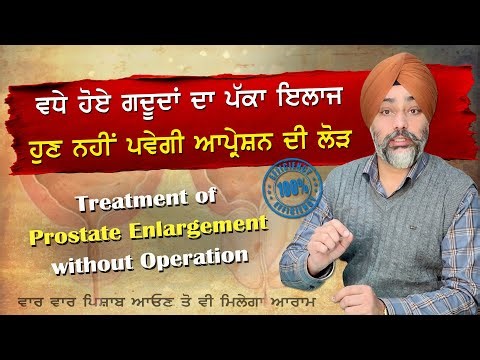 ਵਧੇ ਗਦੂਦਾਂ ਦਾ ਪੱਕਾ ਇਲਾਜ || ਵਾਰ-ਵਾਰ ਪਿਸ਼ਾਬ ਆਉਣ ਪਿੱਛੇ ਇਹ ਹੈ ਕਾਰਨ || Prostate Gland || ‪@dstalanian‬