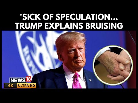 Trump Blames Aspirin for Bruises on His Hands, Defends Health In Latest Interview | 4K | N18G