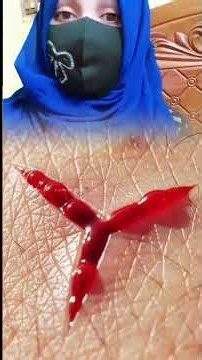 How Leeches Drink Blood: The Terrifying Science Behind Leech Bites #shorts