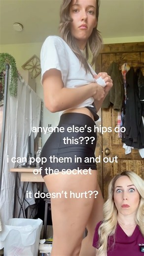 Doctor reacts: her hip popped out?!